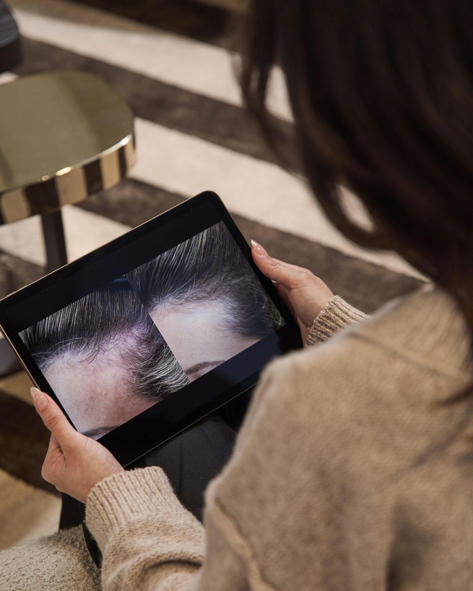 Effloressence Finaux 09 - Effloressence: What If We Finally Talked About Hair Loss?